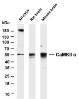 Fascin (PT0620R) PT® Rabbit mAb