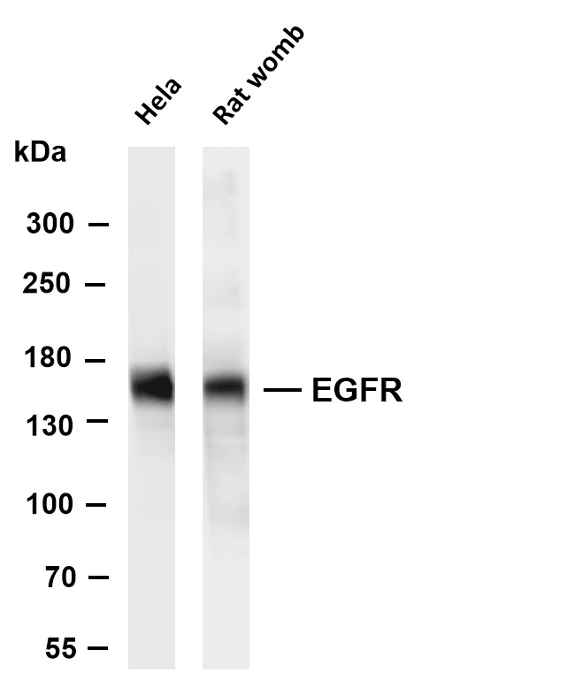 EGFR (PT0520R) PT® Rabbit mAb