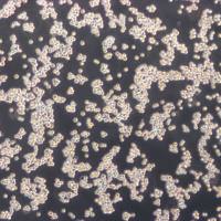 NTERA-2 Cells人恶性多发性畸胎瘤细胞库复苏传代|STR图谱