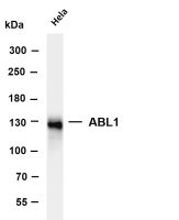 ERK5 (PT0140R) PT® Rabbit mAb