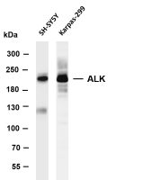 ALK (PT0548R) PT® Rabbit mAb