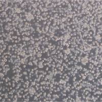 NCI-H82 Cells人小细胞肺癌细胞库复苏传代|STR图谱