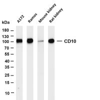 Catenin δ-1 (PT0068R) PT® Rabbit mAb