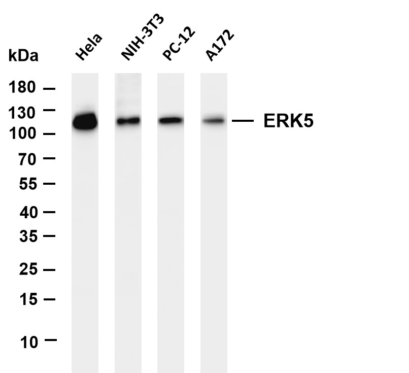 ABL1 (PT0154R) PT® Rabbit mAb