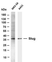 Slug (PT0536R) PT® Rabbit mAb