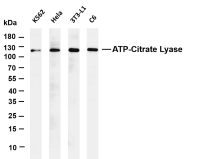 ATP-Citrate Lyase (PT0552R) PT® Rabbit mAb