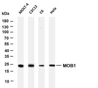 HSP27 (PT0429R) PT® Rabbit mAb