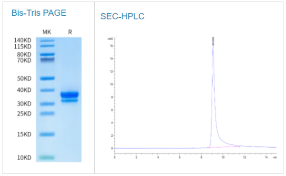 小鼠HMGB1蛋白品质保障，价格惊喜