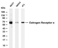 Estrogen Receptor α (PT0632R) PT® Rabbit mAb