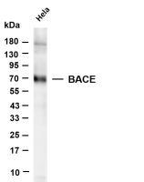 BACE (PT0655R) PT® Rabbit mAb