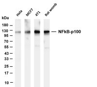 NFkB-p100 (PT0571R) PT® Rabbit mAb