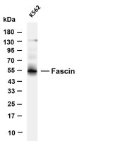 CaMKII α (PT0622R) PT® Rabbit mAb