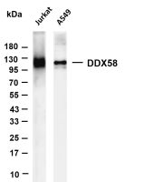 DDX58 (PT0686R) PT® Rabbit mAb