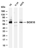 SOX10 (PT0644R) PT® Rabbit mAb