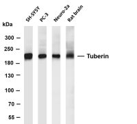 Clathrin Heavy Chain (PT0347R) PT® Rabbit mAb