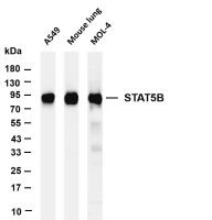RSK2 (PT0827R) PT® Rabbit mAb