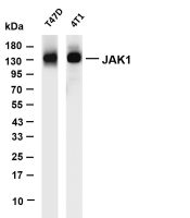 JAK1 (PT0658R) PT® Rabbit mAb