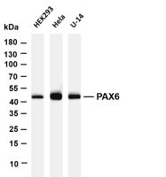 PAX6 (PT0618R) PT® Rabbit mAb