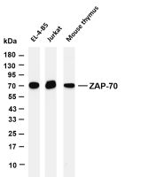 ZAP-70 (PT0656R) PT® Rabbit mAb