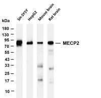 TBR1 (PT0725R) PT® Rabbit mAb