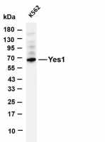 Src Family (Phospho Tyr416) (PT0664R) PT® Rabbit mAb
