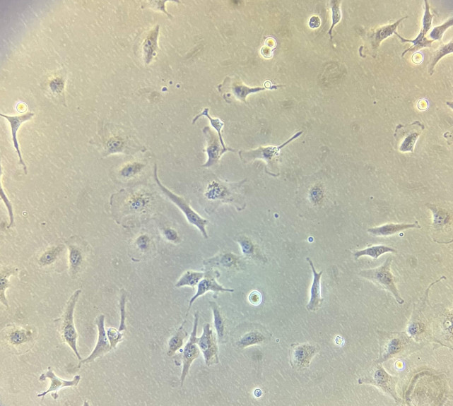 HK2细胞呈镰刀状或不规则状