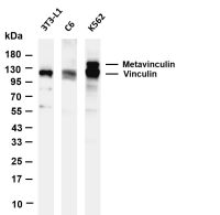 Vinculin (PT0625R) PT® Rabbit mAb