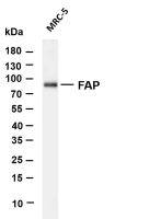 FAP (PT0578R) PT® Rabbit mAb