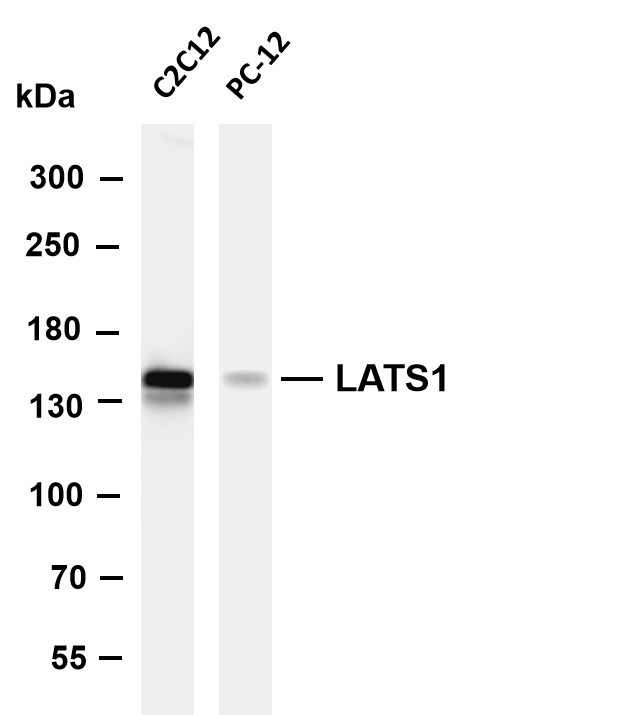 LATS1 (PT0609R) PT® Rabbit mAb