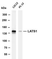LATS1 (PT0609R) PT® Rabbit mAb