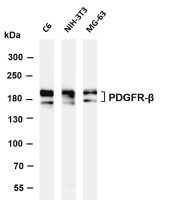 PDGFR-β (PT0604R) PT® Rabbit mAb