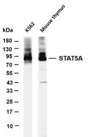 Ctip2 (PT0872R) PT® Rabbit mAb