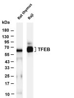 TFEB (PT0684R) PT® Rabbit mAb