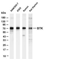 ATG16L1 (PT0690R) PT® Rabbit mAb