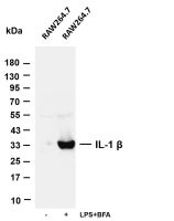 IL-1 β (PT0689R) PT® Rabbit mAb