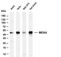 MEK4 (PT0589R) PT® Rabbit mAb