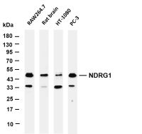 NDRG1 (PT0568R) PT® Rabbit mAb