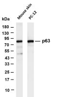 p63 (PT0645R) PT® Rabbit mAb
