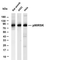 p90RSK (phospho Ser380) (PT0759R) PT® Rabbit mAb
