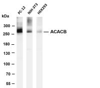 Acetyl Coenzyme A Carboxylase beta (PT0598R) PT® Rabbit mAb