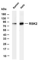 STAT5b (PT0851R) PT® Rabbit mAb
