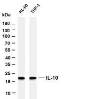 IL-10 (PT0635R) PT® Rabbit mAb