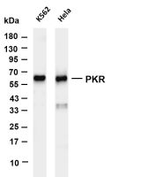 Chk2 (PT0672R) PT® Rabbit mAb