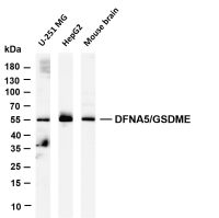 DFNA5/GSDME (PT0634R) PT® Rabbit mAb