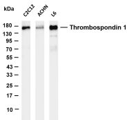 Thrombospondin 1 (PT0693R) PT® Rabbit mAb