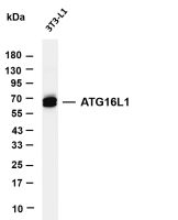 BTK (PT0682R) PT® Rabbit mAb