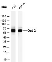 DDX5 (PT0692R) PT® Rabbit mAb