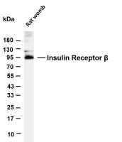Insulin Receptor β (PT0688R) PT® Rabbit mAb