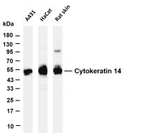 Cytokeratin 14 (PT0630R) PT® Rabbit mAb