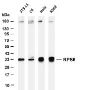 RPS6 (PT0676R) PT® Rabbit mAb